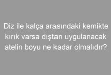 Diz ile kalça arasındaki kemikte kırık varsa dıştan uygulanacak atelin boyu ne kadar olmalıdır?